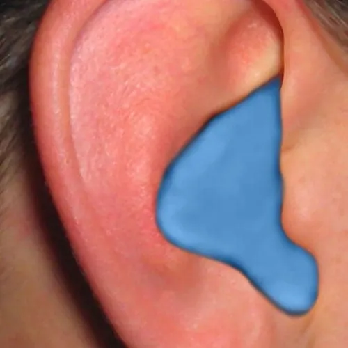 Radians DIY Custom Molded Earplugs